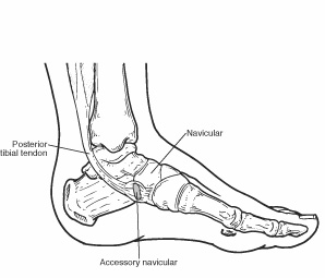 inner foot pain near arch