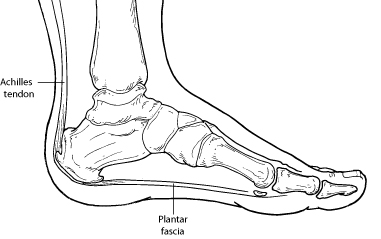 Plantar Fasciitis – Heel Pain  Foot Health Facts - Foot Health Facts