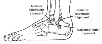Sprained Ankles, Types, Causes & Recovery Time