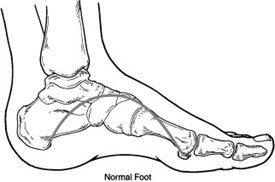 chart foot disease